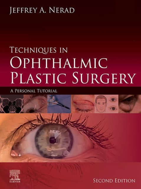 E-book Techniques in Ophthalmic Plastic Surgery E-Book Jeffrey A. Nerad