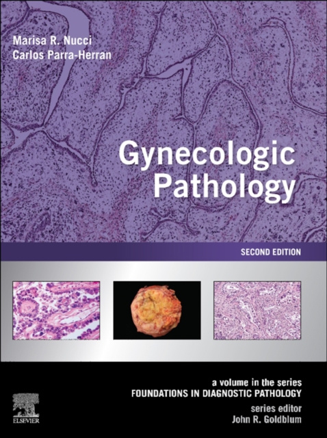 E-kniha Gynecologic Pathology E-Book Marisa R. Nucci