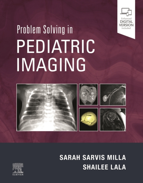 E-Book Problem Solving in Pediatric Imaging E-Book Sarah Sarvis Milla