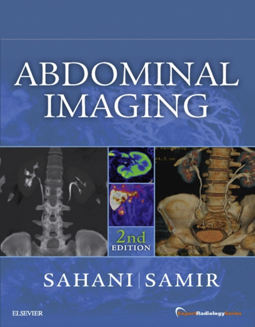 E-book Abdominal Imaging E-Book Dushyant V Sahani