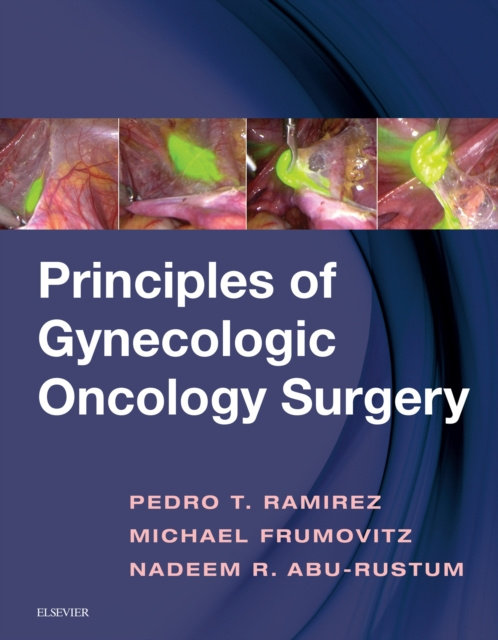 E-kniha Principles of Gynecologic Oncology Surgery E-Book Pedro T. Ramirez