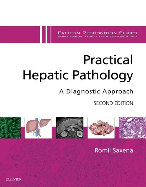 E-kniha Practical Hepatic Pathology: A Diagnostic Approach E-Book Romil Saxena