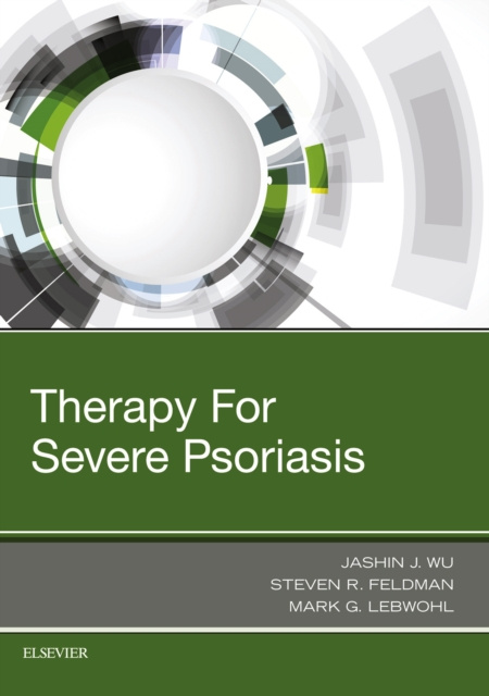E-book Therapy for Severe Psoriasis E-Book Jashin J. Wu