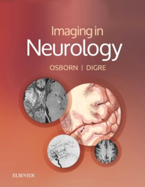 E-kniha Imaging in Neurology E-Book Anne G. Osborn