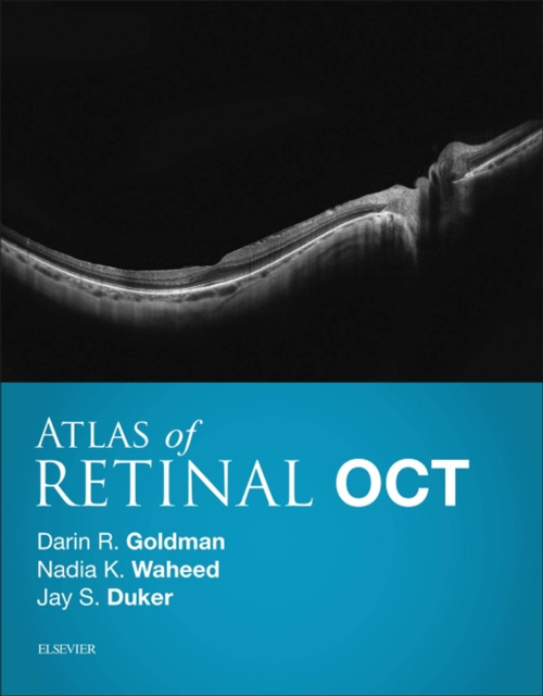 E-kniha Atlas of Retinal OCT E-Book Darin Goldman