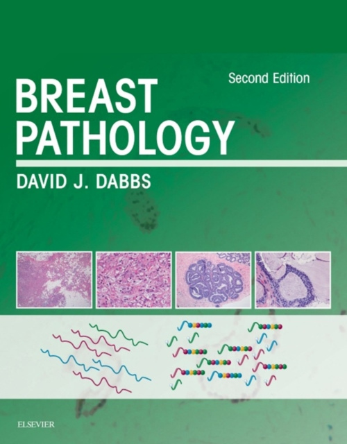 E-kniha Breast Pathology E-Book David J Dabbs