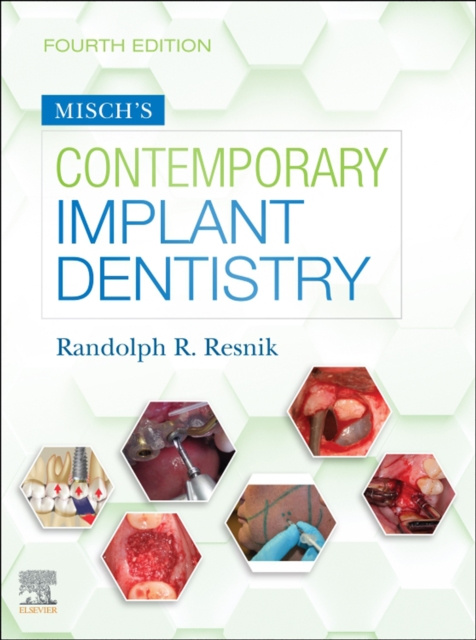E-kniha Misch's Contemporary Implant Dentistry E-Book Randolph Resnik