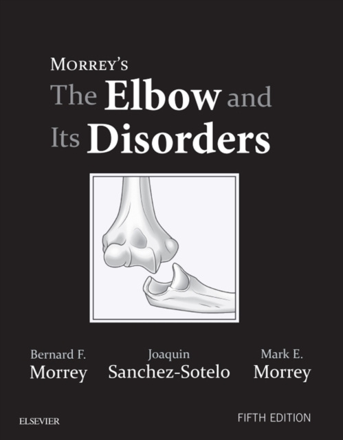 E-kniha Morrey's The Elbow and Its Disorders E-Book Bernard F. Morrey