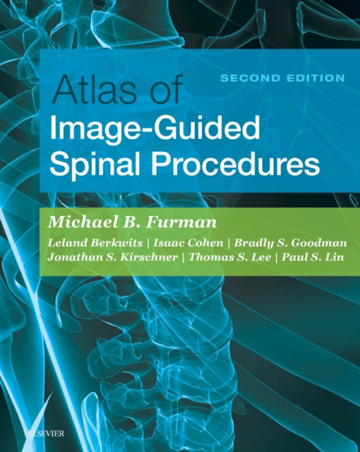 E-knjiga Atlas of Image-Guided Spinal Procedures E-Book Michael Bruce Furman