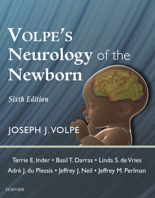 E-Book Volpe's Neurology of the Newborn E-Book Joseph J. Volpe