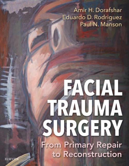 E-book Facial Trauma Surgery E-Book Amir H Dorafshar