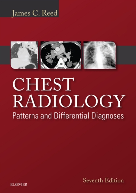 E-kniha Chest Radiology: Patterns and Differential Diagnoses E-Book James C. Reed
