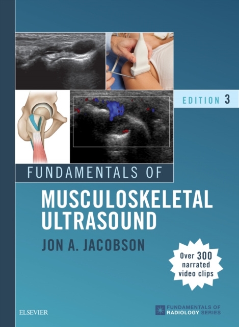 E-kniha Fundamentals of Musculoskeletal Ultrasound E-Book Jon A. Jacobson