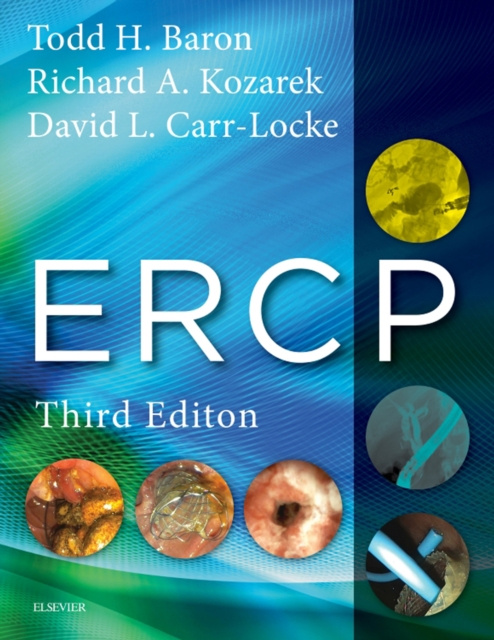E-knjiga ERCP E-Book Todd H. Baron
