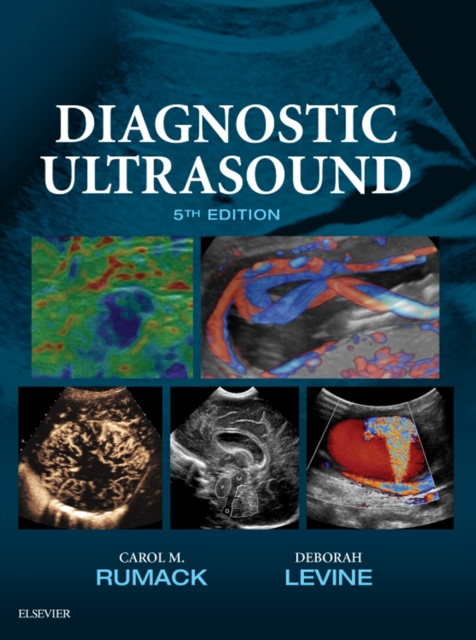 E-kniha Diagnostic Ultrasound Carol M. Rumack