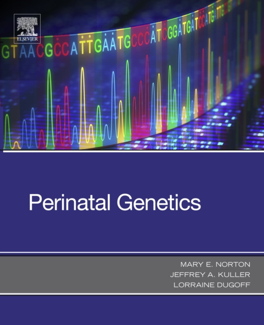 E-book Perinatal Genetics Mary E Norton