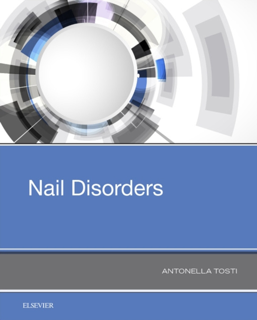 E-knjiga Nail Disorders Antonella Tosti