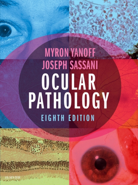 E-Book Ocular Pathology Myron Yanoff