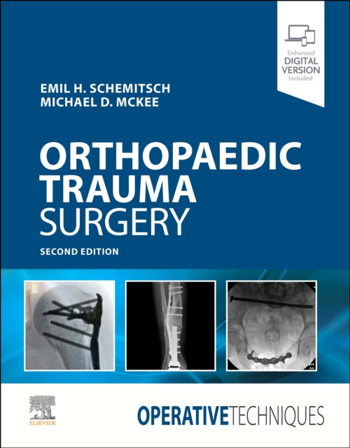 E-book Operative Techniques: Orthopaedic Trauma Surgery E-Book Emil Schemitsch