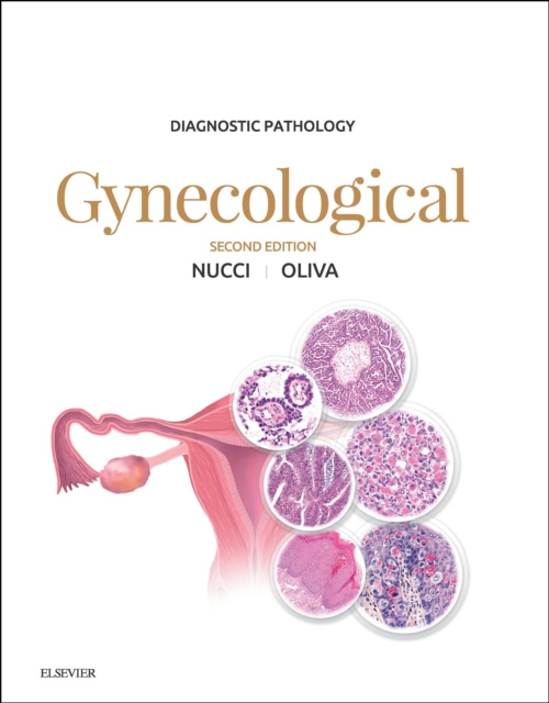 E-kniha Diagnostic Pathology: Gynecological E-Book Marisa R. Nucci