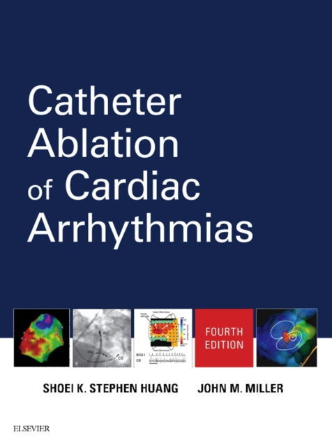 E-kniha Catheter Ablation of Cardiac Arrhythmias E-Book Shoei K. Stephen Huang