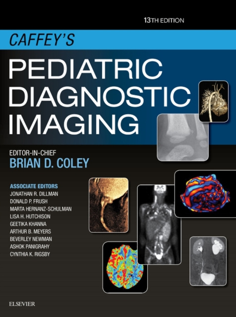 E-knjiga Caffey's Pediatric Diagnostic Imaging E-Book Brian D. Coley