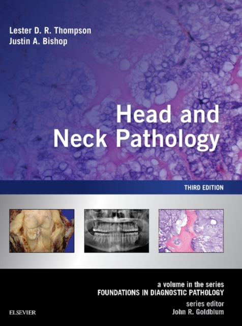 E-kniha Head and Neck Pathology E-Book Lester D. R. Thompson