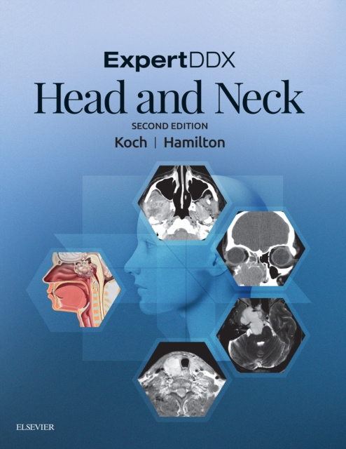 E-book ExpertDDX: Head and Neck - E-Book Bernadette L. Koch