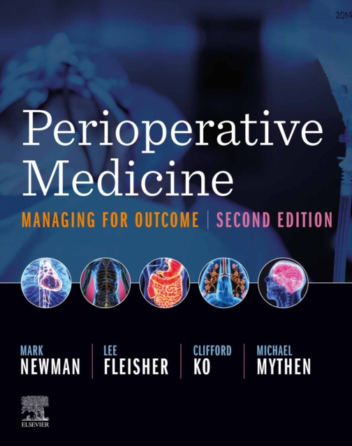 E-kniha Perioperative Medicine E-Book Mark F. Newman
