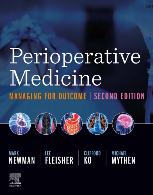 E-book Perioperative Medicine E-Book Mark F. Newman