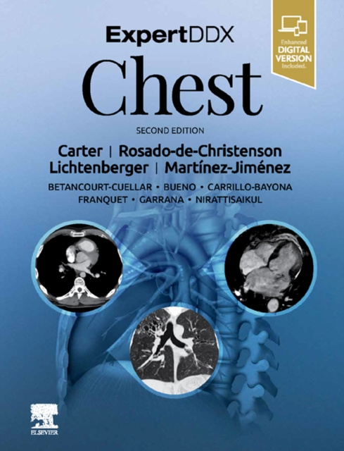 E-book ExpertDDx: Chest Brett W. Carter