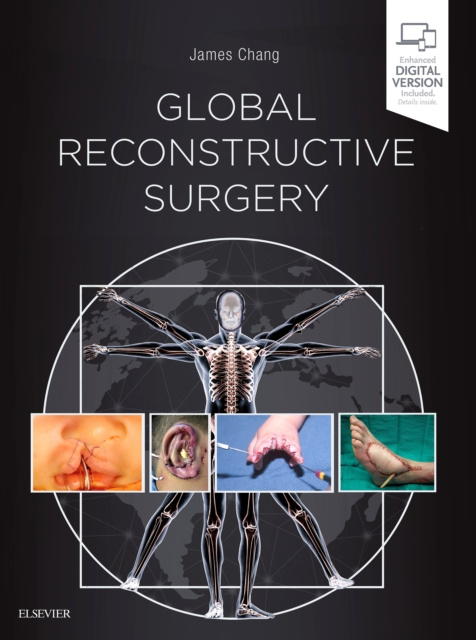 E-Book Global Reconstructive Surgery James Chang
