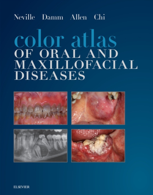 E-kniha Color Atlas of Oral and Maxillofacial Diseases - E-Book Brad W. Neville