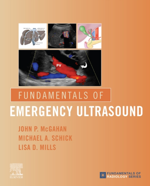 E-kniha Fundamentals of Emergency Ultrasound John P. McGahan