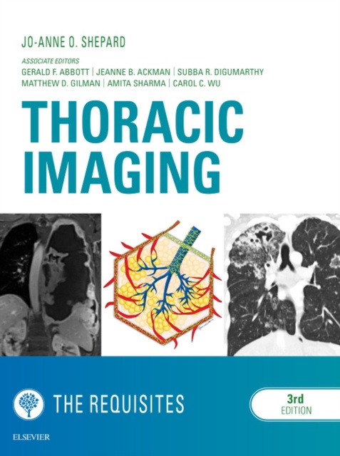 E-knjiga Thoracic Imaging The Requisites E-Book Jo-Anne O Shepard