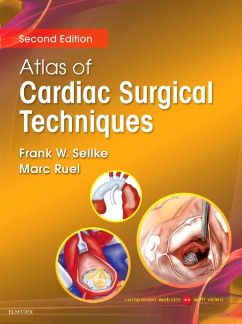 E-kniha Atlas of Cardiac Surgical Techniques E-Book Frank Sellke
