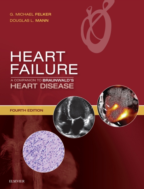 E-kniha Heart Failure: A Companion to Braunwald's Heart Disease E-Book G. Michael Felker