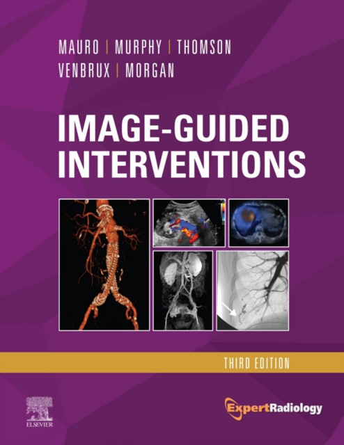 E-book Image-Guided Interventions E-Book Matthew A. Mauro