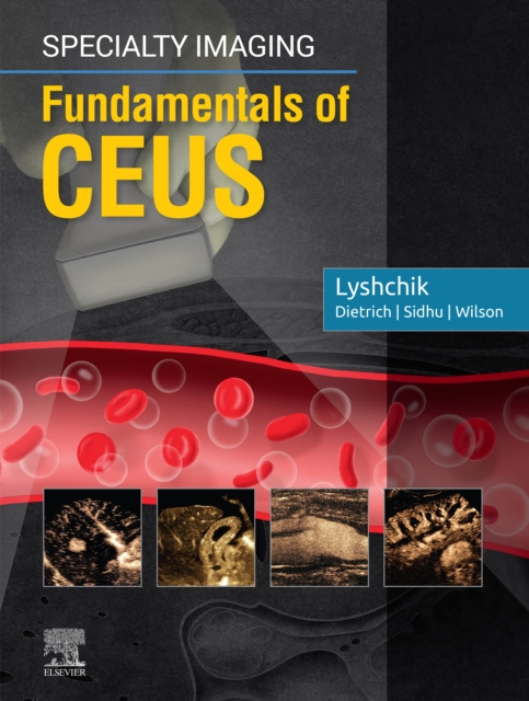 E-kniha Specialty Imaging: Fundamentals of CEUS E-Book Andrej Lyshchik