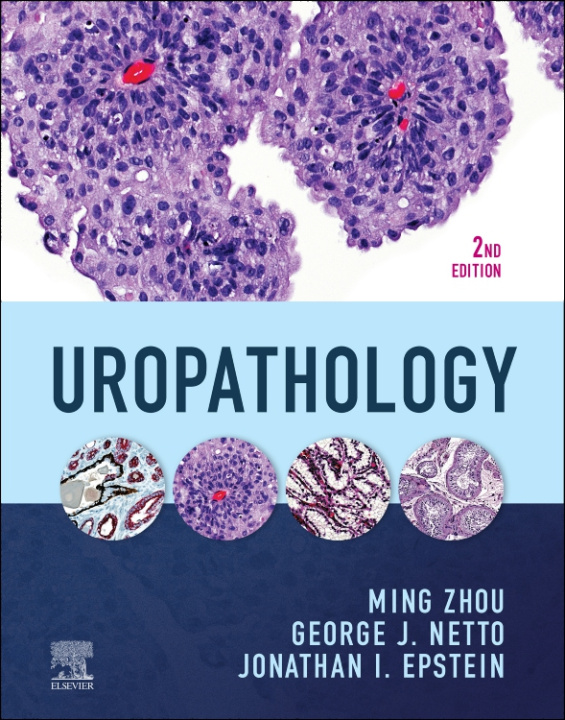 E-book Uropathology E-Book Ming Zhou