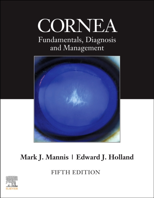 E-knjiga Cornea, E-Book Mark J. Mannis