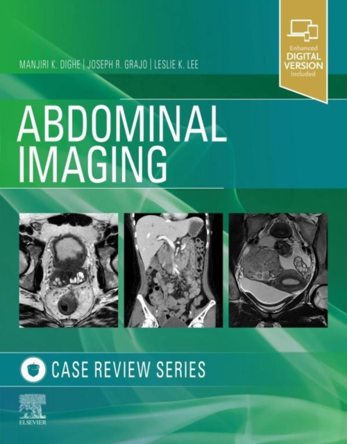 E-knjiga Abdominal Imaging Manjiri Dighe
