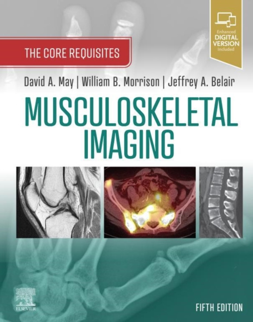 E-kniha Musculoskeletal Imaging: The Core Requisites E-Book David A. May