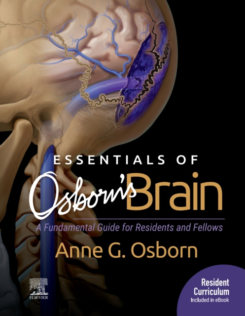 E-kniha Essentials of Osborn's Brain E-Book Anne G. Osborn