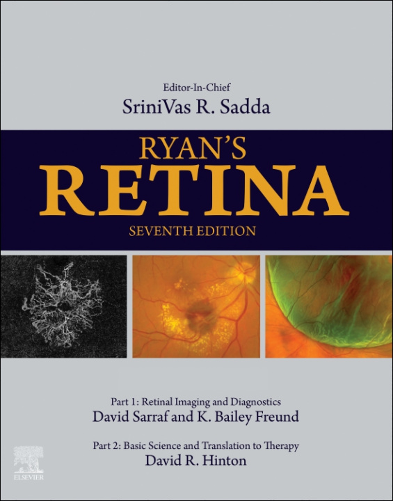 E-book Ryan's Retina SriniVas R. Sadda
