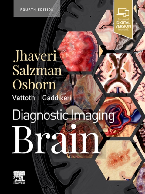 E-Book Diagnostic Imaging: Brain E-Book Miral D Jhaveri