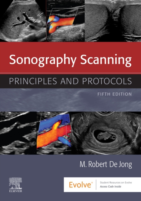 E-book Sonography Scanning E-Book M. Robert de Jong