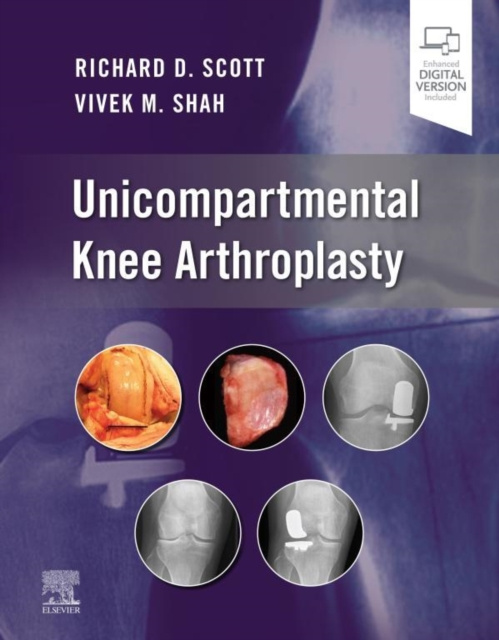 E-kniha Unicompartmental Knee Arthroplasty, E-Book Richard D. Scott