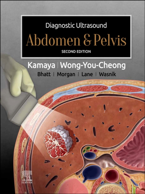 E-kniha Diagnostic Ultrasound: Abdomen and Pelvis E-Book Aya Kamaya