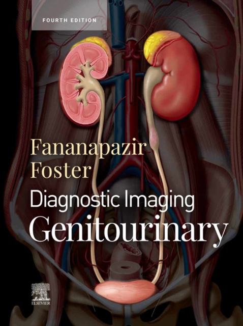 E-book Diagnostic Imaging: Genitourinary, E-Book Bryan R. Foster